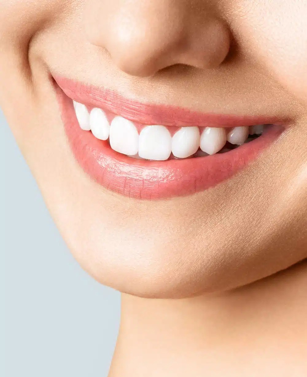 Dental Bridges London