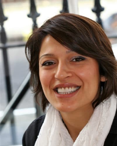 Non-Prep Veneers Makeover