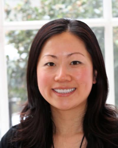 Minimal Prep Veneers: Perfect Smile