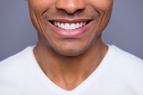 Philips Teeth Whitening London